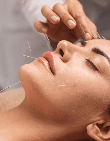 facial acupuncture