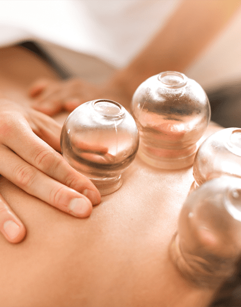 fire cupping