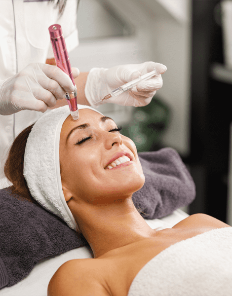 microneedling